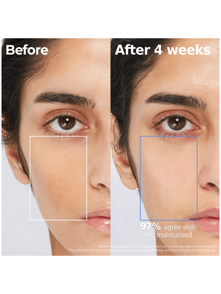 Before and after comparison of skin results using AESTURA Atobarrier 365 Hydro Essence 200ml after 4 weeks.