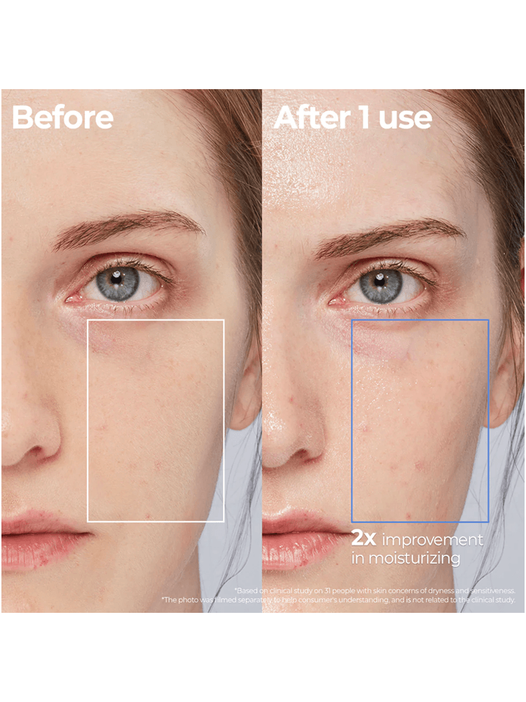 Before and after results of AESTURA Atobarrier 365 Lotion 150ml showing 2x improvement in moisturizing.