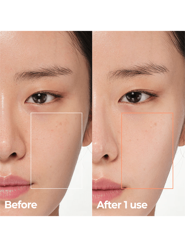 Before and after comparison of skin using AESTURA Derma UV 365 Barrier Hydro Mineral Sunscreen 40ml SPF50+ PA++++.