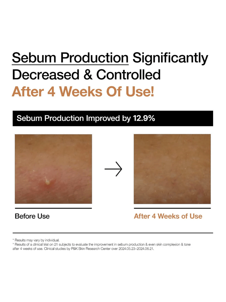 Sebum production results showing a decrease after 4 weeks of use with before and after comparison.