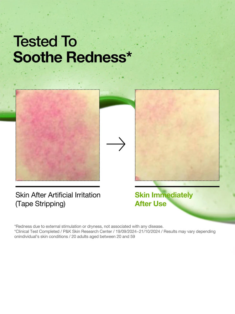 Tested to soothe redness shown in skin before and after using ANUA Azelaic Acid 10 Hyaluron Redness Soothing Serum 30ml.