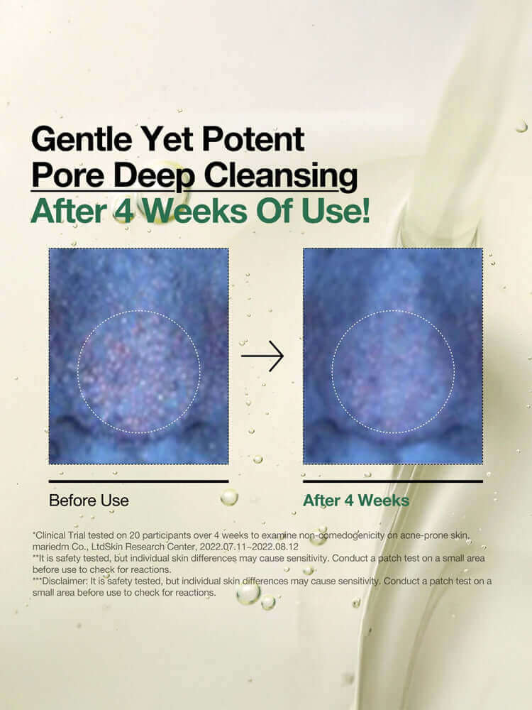 ANUA Hearleaf Pore Control Cleasing Oil 200ml results before and after 4 weeks of use for deep cleansing.