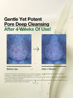 ANUA Hearleaf Pore Control Cleasing Oil 200ml results before and after 4 weeks of use for deep cleansing.