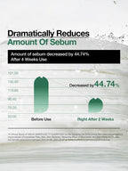 ANUA Heartleaf 77 Clearpad 160ml 70pad efficacy chart showing 44.74% decrease in sebum after four weeks of use.