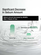 ANUA Heartleaf 77 Soothing Toner 250ml