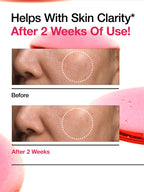 ANUA Niacinamide10 + Txa 4 Dark Spot Removing Serum 30ml