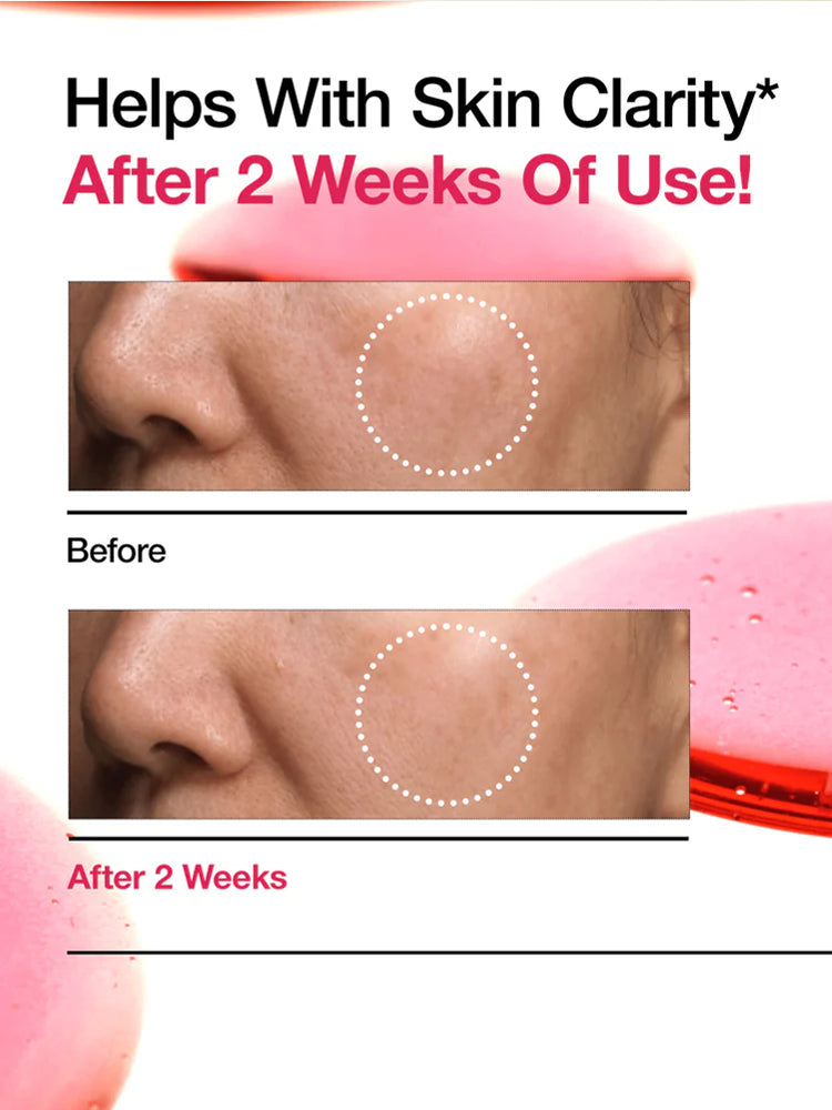 ANUA Niacinamide10 + Txa 4 Dark Spot Removing Serum 30ml