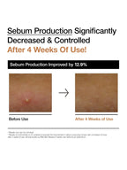 Image showing sebum production improvement after 4 weeks of use with before and after photos.