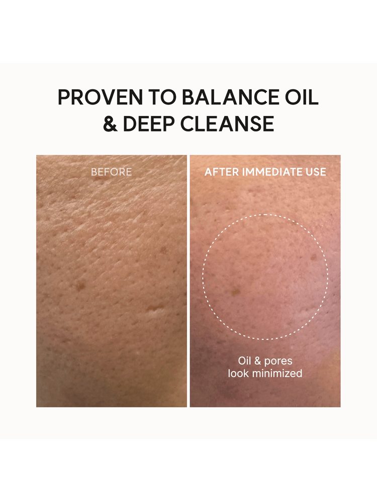 ARENCIA Blue Hyssop Rice Mochi Cleanser results before and after deep cleansing, showing minimized oil and pores.