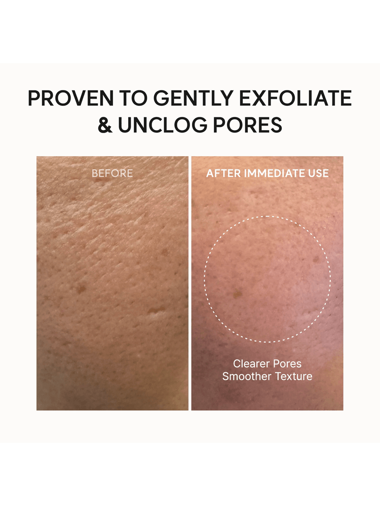 ARENCIA Fresh Green Rice Mochi Cleanser before and after showing clearer pores and smoother texture after immediate use.