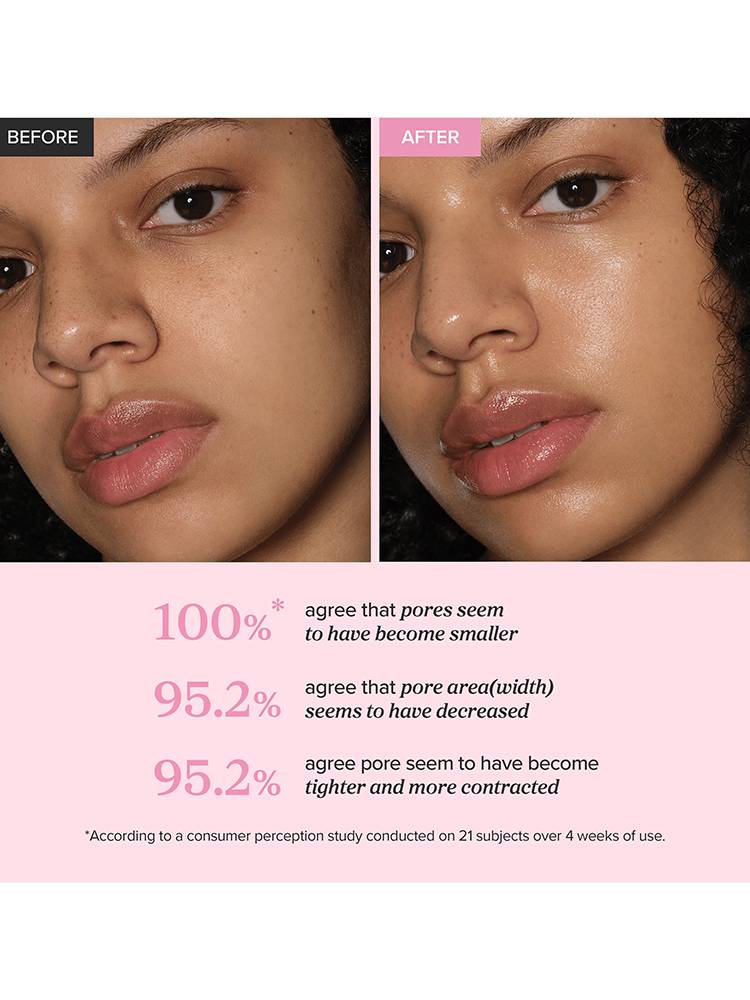 Before and after results of BEAUTY OF JOSEON Pore Firming Serum Red Bean PDRN showing smaller, tighter pores.