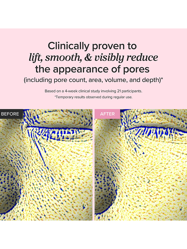 BEAUTY OF JOSEON Pore Firming Serum Red Bean PDRN showing before and after results on pore appearance.