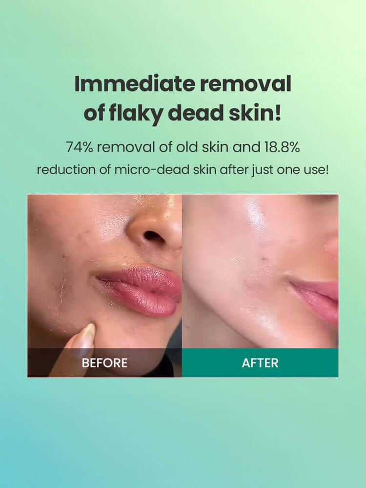 Dr.G Brightening Peeling Gel 120g