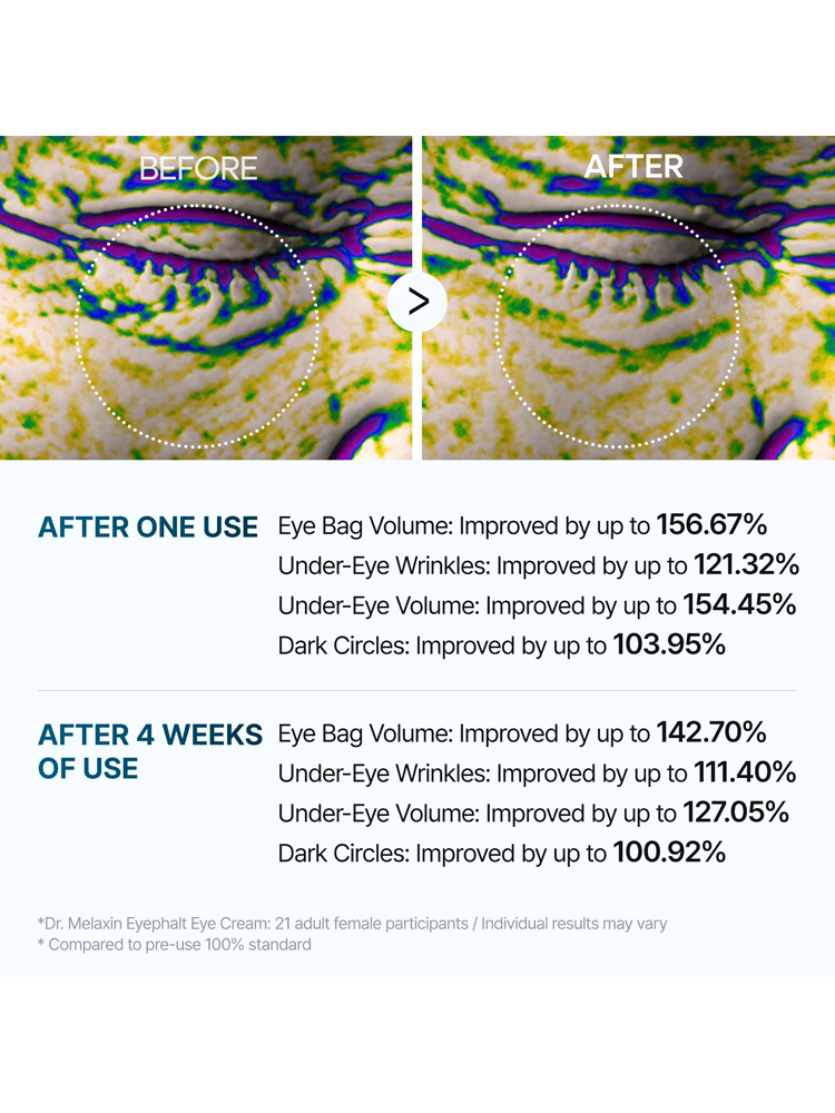 Before and after results of Dr.MELAXIN Eyephalt Eyebag Cream showing improvements in under-eye bags and wrinkles.