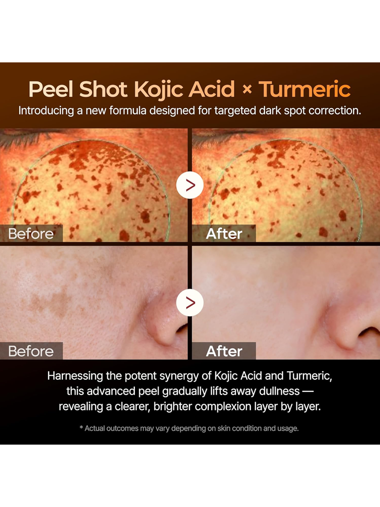 Dr.MELAXIN Peel Shot Exfoliating Kojic Acid Turmeric Serum 80ml