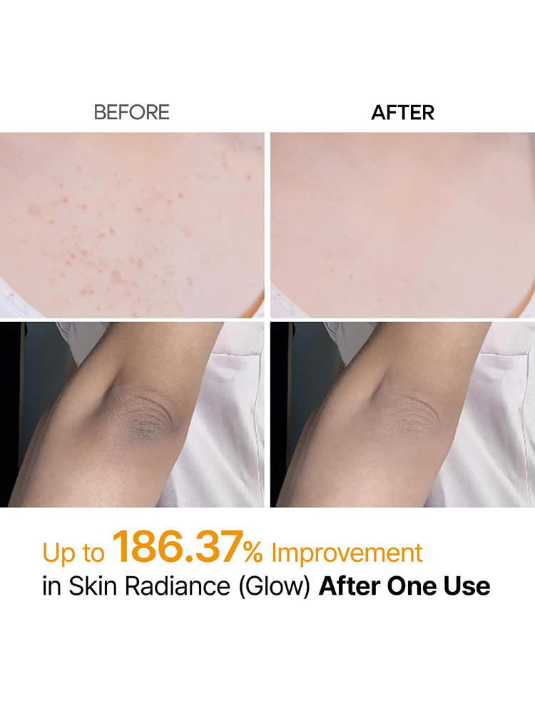 Dr.MELAXIN Peel Shot Exfoliating Kojic Acid Turmeric Spray 200ml