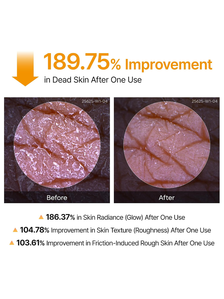 Dr.MELAXIN Peel Shot Exfoliating Kojic Acid Turmeric Spray 200ml