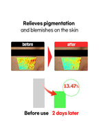 FATION Nosca9 Trouble Toning Ampoule 15ml before and after skin treatment showing reduced pigmentation and blemishes