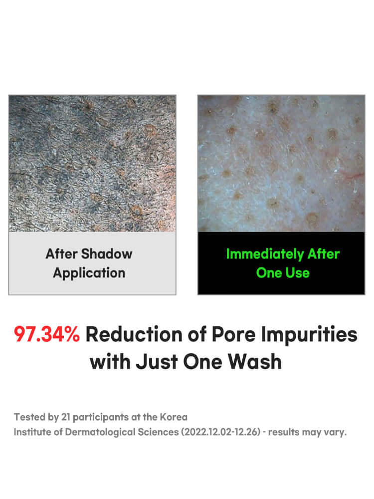 FATION Nosca9 Trouble Cleansing Foam 150ml