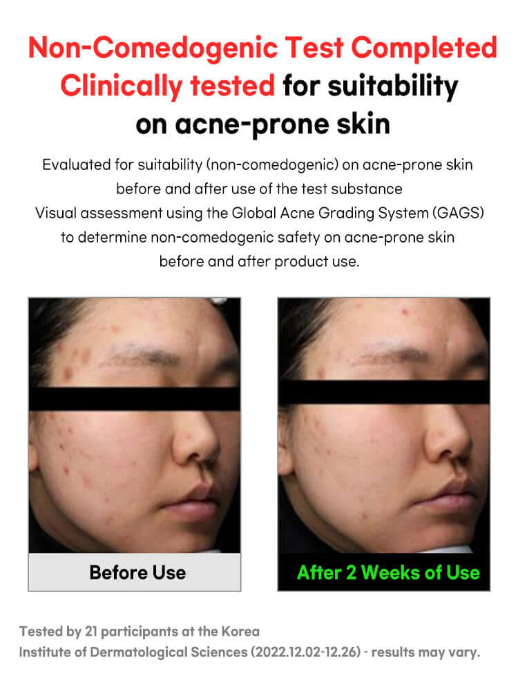 FATION Nosca9 Trouble Cleansing Foam 150ml