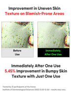 FATION Nosca9 Trouble Cleansing Foam 150ml