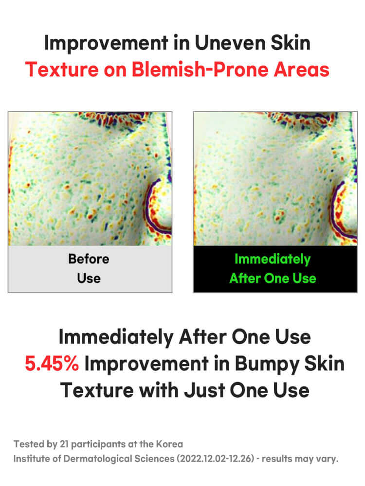 FATION Nosca9 Trouble Cleansing Foam 150ml