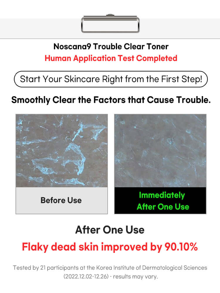 FATION Nosca9 Trouble Clear Toner 200ml