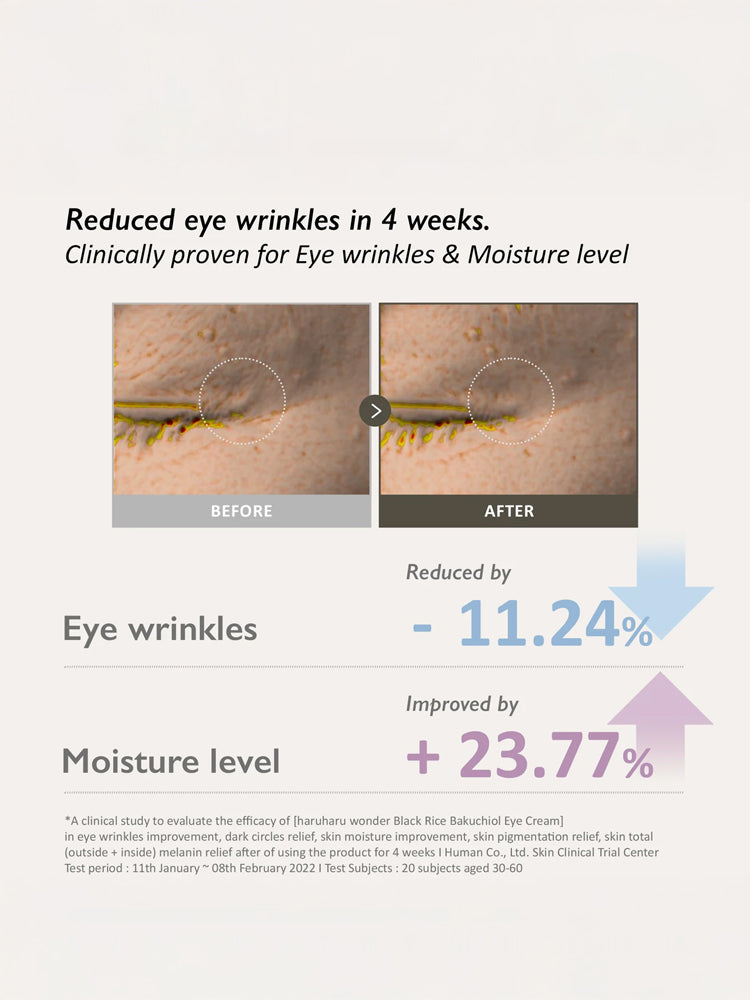 Before and after results of HARUHARU WONDER Black Rice Bakuchiol Eye Cream 20ml showing reduced eye wrinkles and improved moisture level.