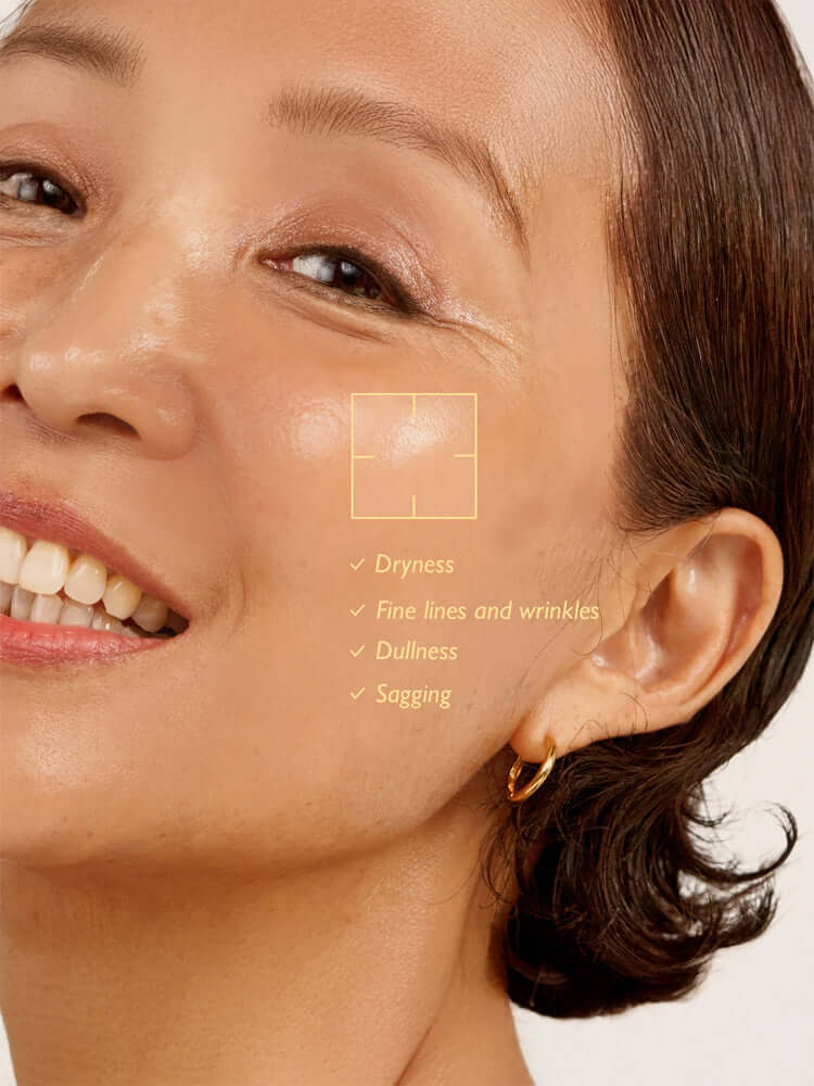 Close-up of a smiling woman showing glowing skin with notes on dryness, fine lines, dullness, and sagging for HARUHARU WONDER Black Rice Hyaluronic Anti-wrinkle Serum 50ml.