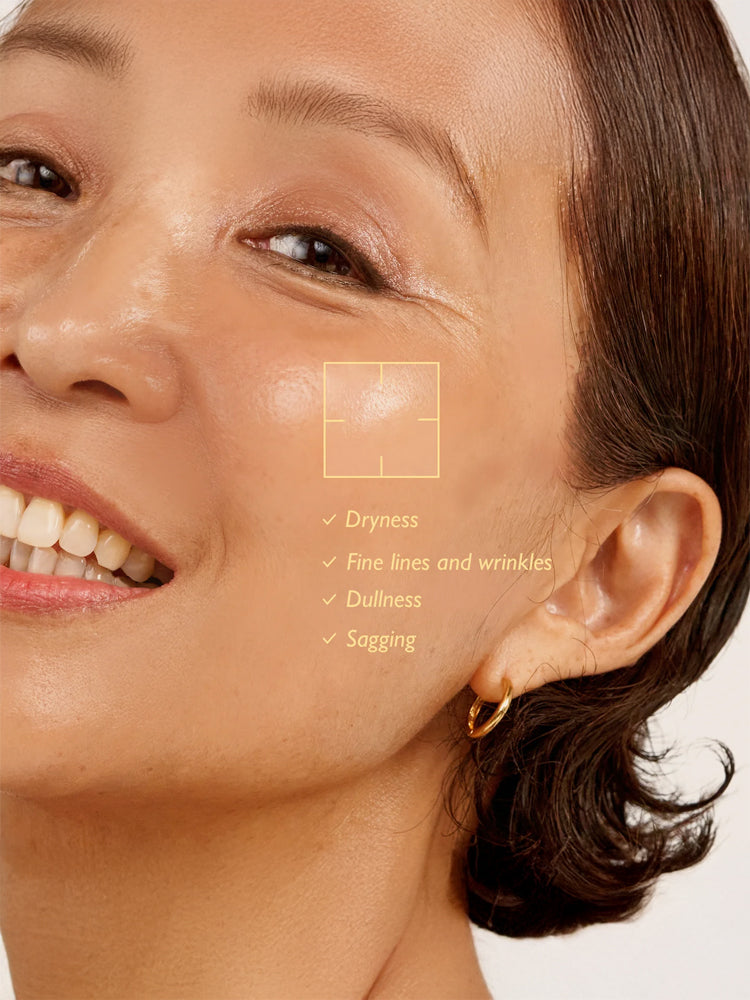 Close-up of a smiling woman showing glowing skin with notes on dryness, fine lines, dullness, and sagging for HARUHARU WONDER Black Rice Hyaluronic Anti-wrinkle Serum 50ml.