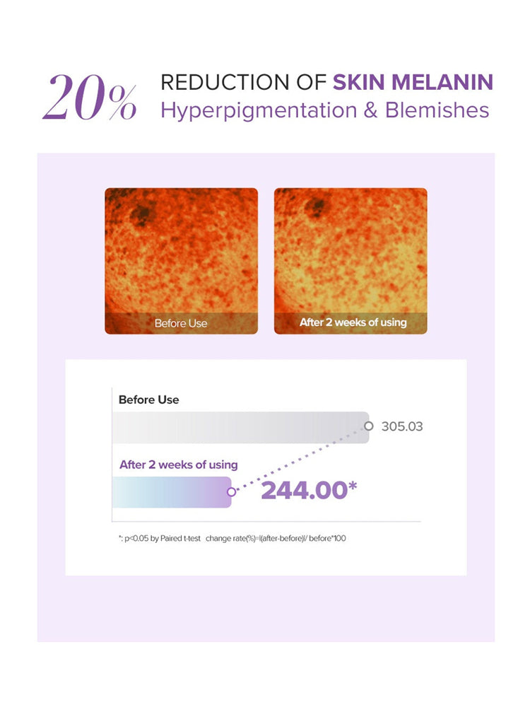 Before and after results showing 20% reduction of skin melanin after using glutathione eye cream set for 2 weeks