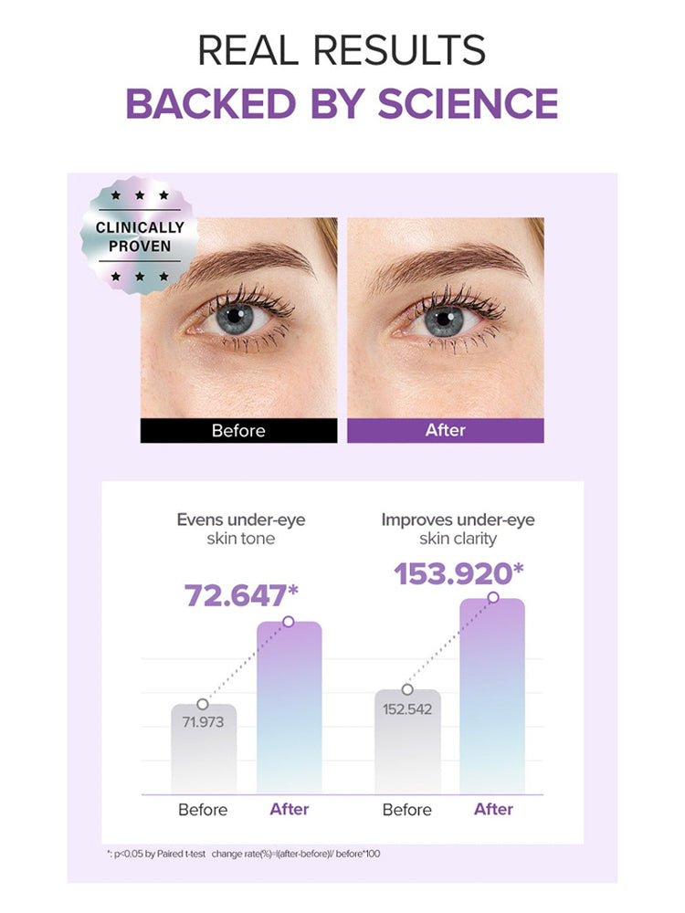 Before and after results of glutathione eye cream set showing improvement in under-eye skin tone and clarity.