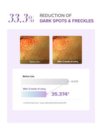 Before and after results showing 33.3% reduction of dark spots and freckles after using glutathione eye cream set.