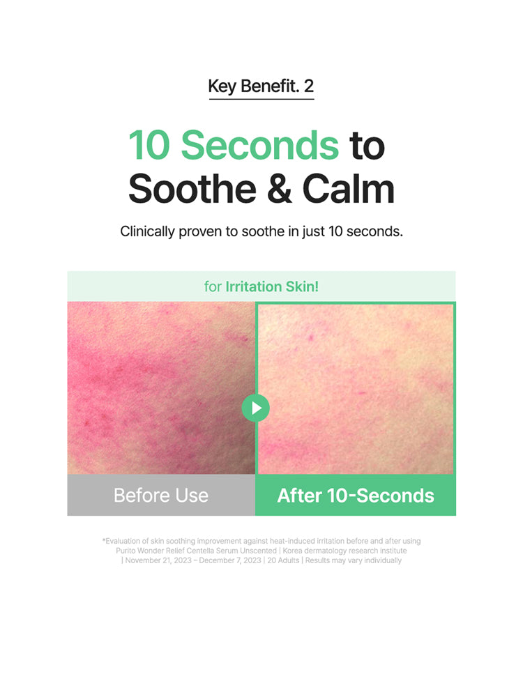 Before and after images showing 10 seconds to soothe and calm irritation with PURITO Centella Unscented Serum 60ml.