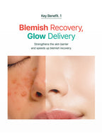 Key benefits of PURITO Mighty Bamboo Panthenol Cream 100ml: Blemish recovery and glow delivery for healthy skin.