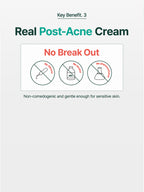 Key benefit of Real Post-Acne Cream highlighting no breakouts, alcohol, or phenoxyethanol for sensitive skin.