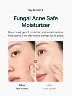 Before and after images demonstrating the effect of PURITO Oat In Calming Gel Cream 100ml on skin, showing redness improvement.