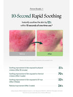 Before and after results of PURITO Wonder Releaf Centella Cream Unscented 50ml showing rapid soothing improvements.