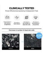 ROUND LAB 1025 Dokdo Toner Lotion Special Set (Toner 200ml+Lotion 200ml) Clinically tested results showing before and after effects.