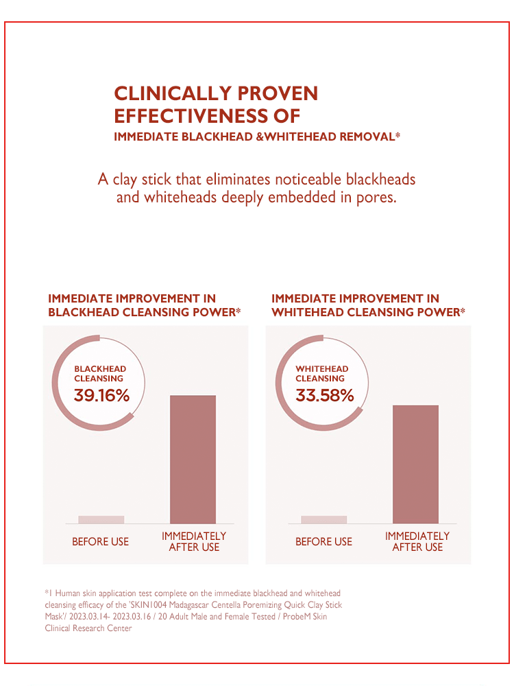 SKIN1004 Madagascar Centella Poremizing Quick Clay Stick Mask clinical effectiveness chart for blackhead and whitehead removal.