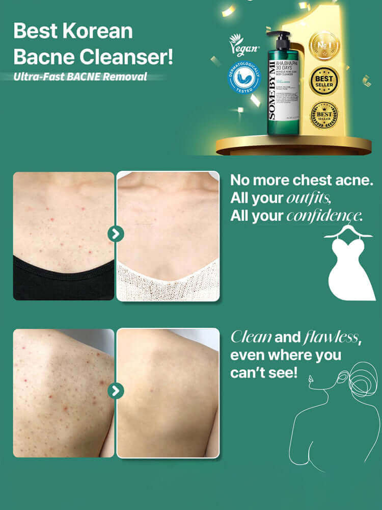 SOME BY MI AHA-BHA-PHA 30 Days Miracle Acne Clear Body Cleanser 400g best Korean bacne cleanser for fast removal